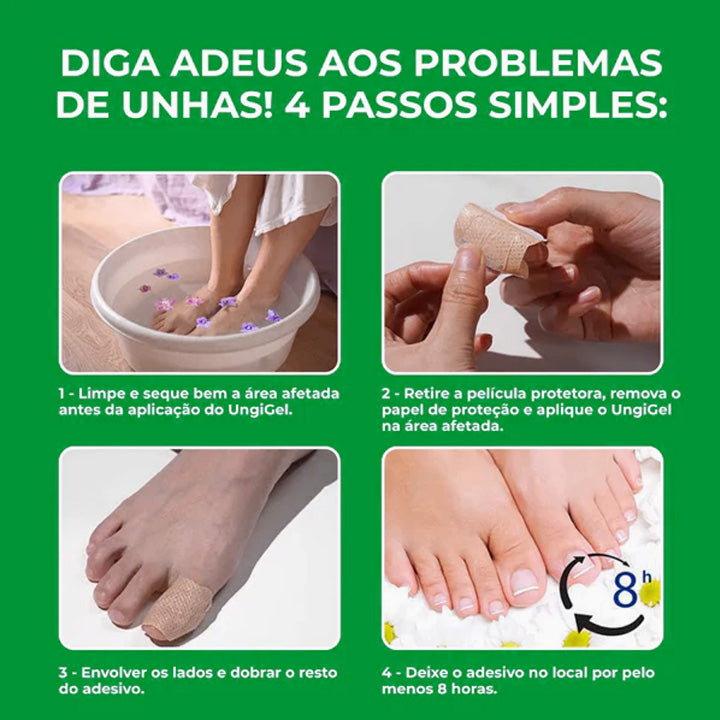 O único adesivo antifúngico que elimina fungos imediatamente - NutriNail®