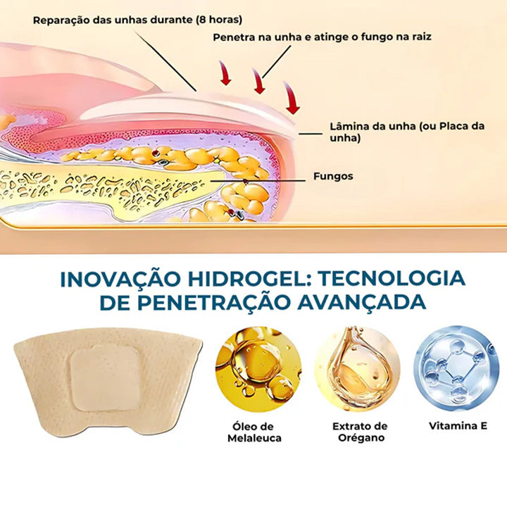 O único adesivo antifúngico que elimina fungos imediatamente - NutriNail®