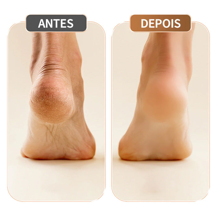 O Segredo Para Pés Perfeitos e Livres de Calos - CleanPro