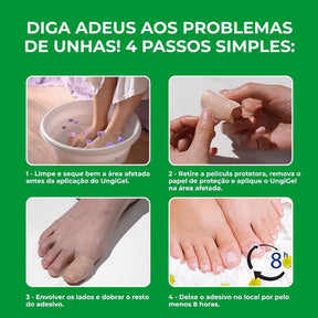 O único adesivo antifúngico que elimina fungos imediatamente - NutriNail®