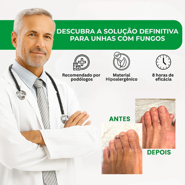 O único adesivo antifúngico que elimina fungos imediatamente - NutriNail®