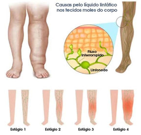 Dispositivo Linfático que Corrige a Postura e Reduz Peso - SmartPro